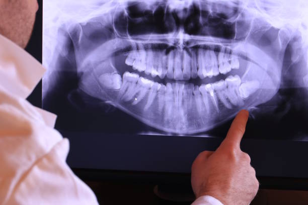 Best Broken or Cracked Tooth Emergency Dentist in Mineola, NY